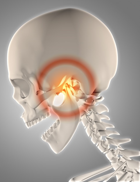 Temporomandibular Joint (TMJ) Treatment
