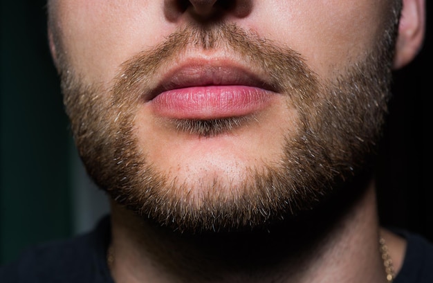 Beard and Mustache Transplant