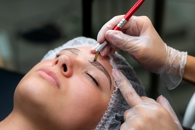 Eyebrow Transplantation