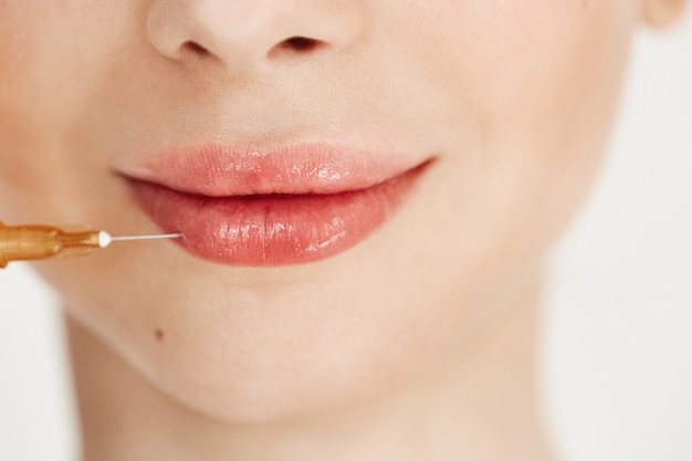 Lip Filler