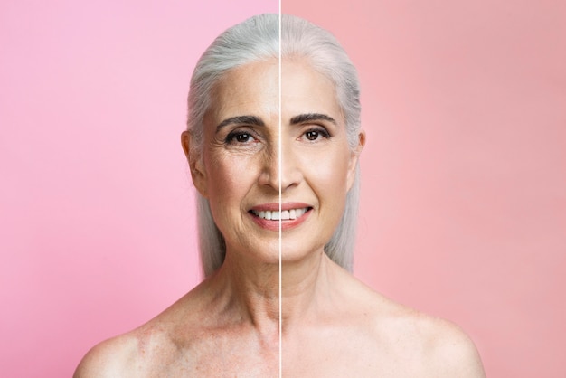 Skin Rejuvenation (PRP)