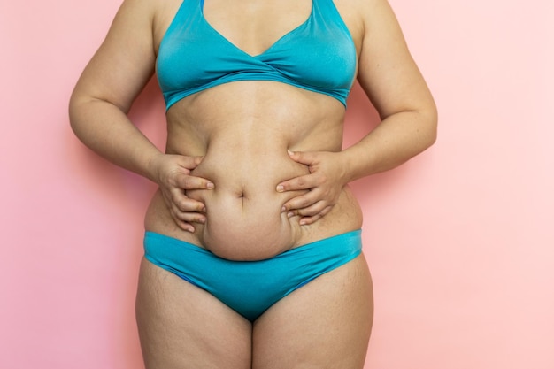 Liposuction